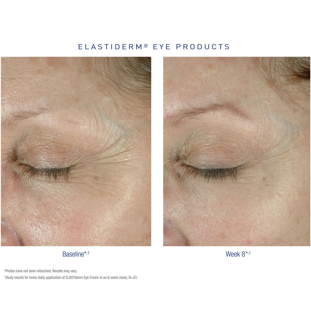 Obagi ELASTIderm Eye Cream - The Milecross Clinic