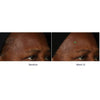ELASTIderm® - Facial Serum-The Facial Rejuvenation Clinic