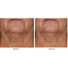 ELASTIderm® - Facial Serum-The Facial Rejuvenation Clinic